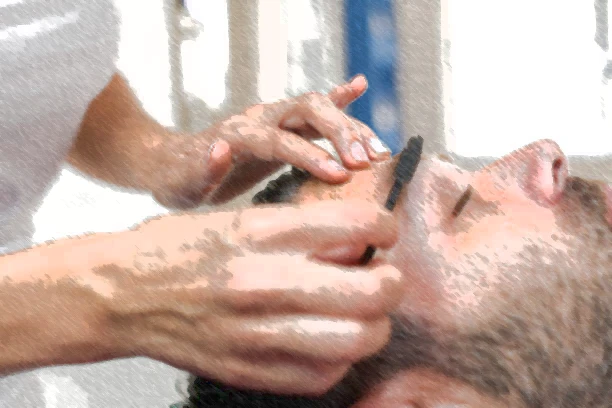 Epilation