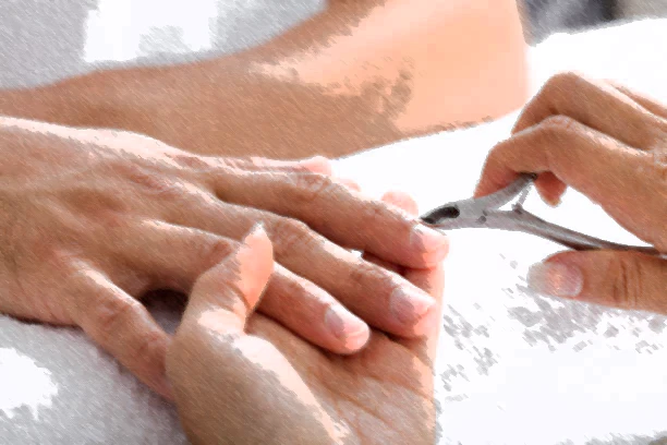 Epilation